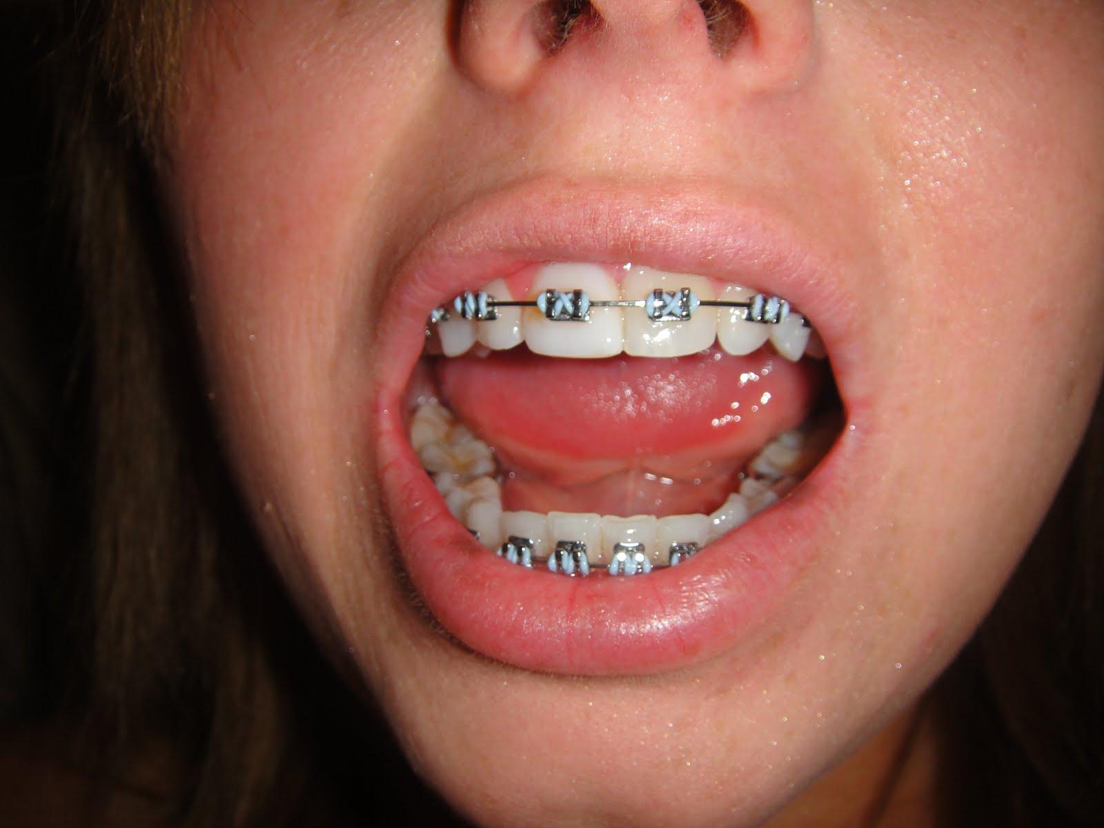 corinna st orthodontics