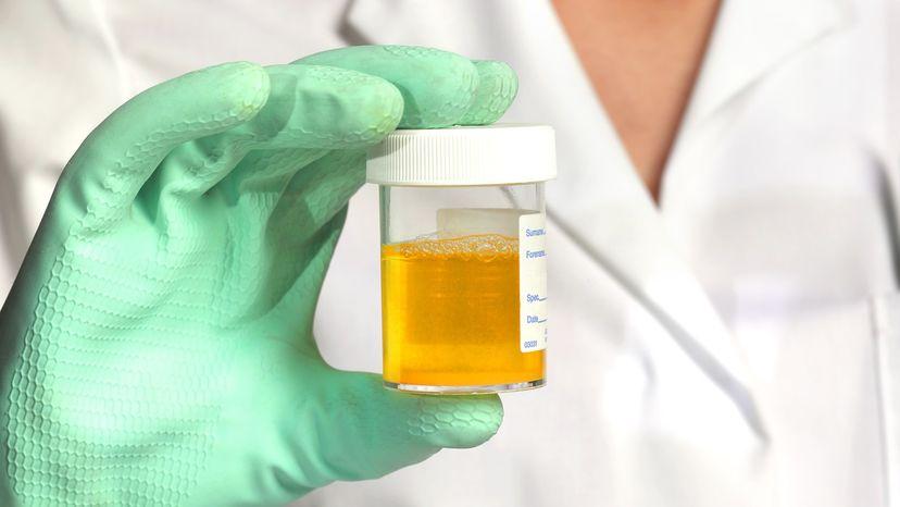 How to Remove Urine Stains: Tips and Guidelines | HowStuffWorks