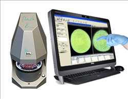 Global Automated Colony Counter Future market data