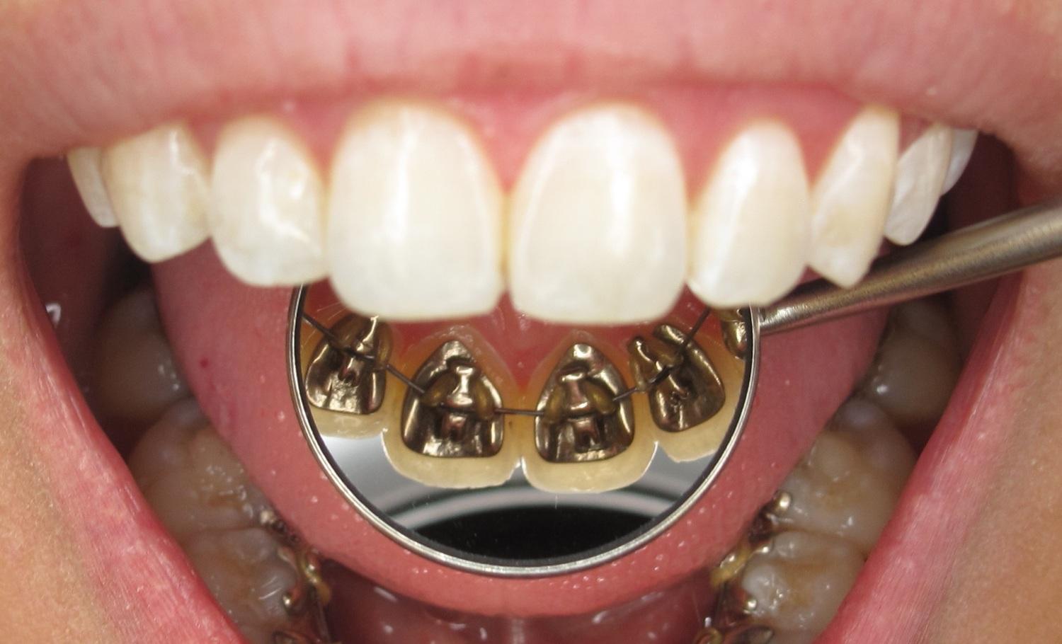 canberra orthodontist