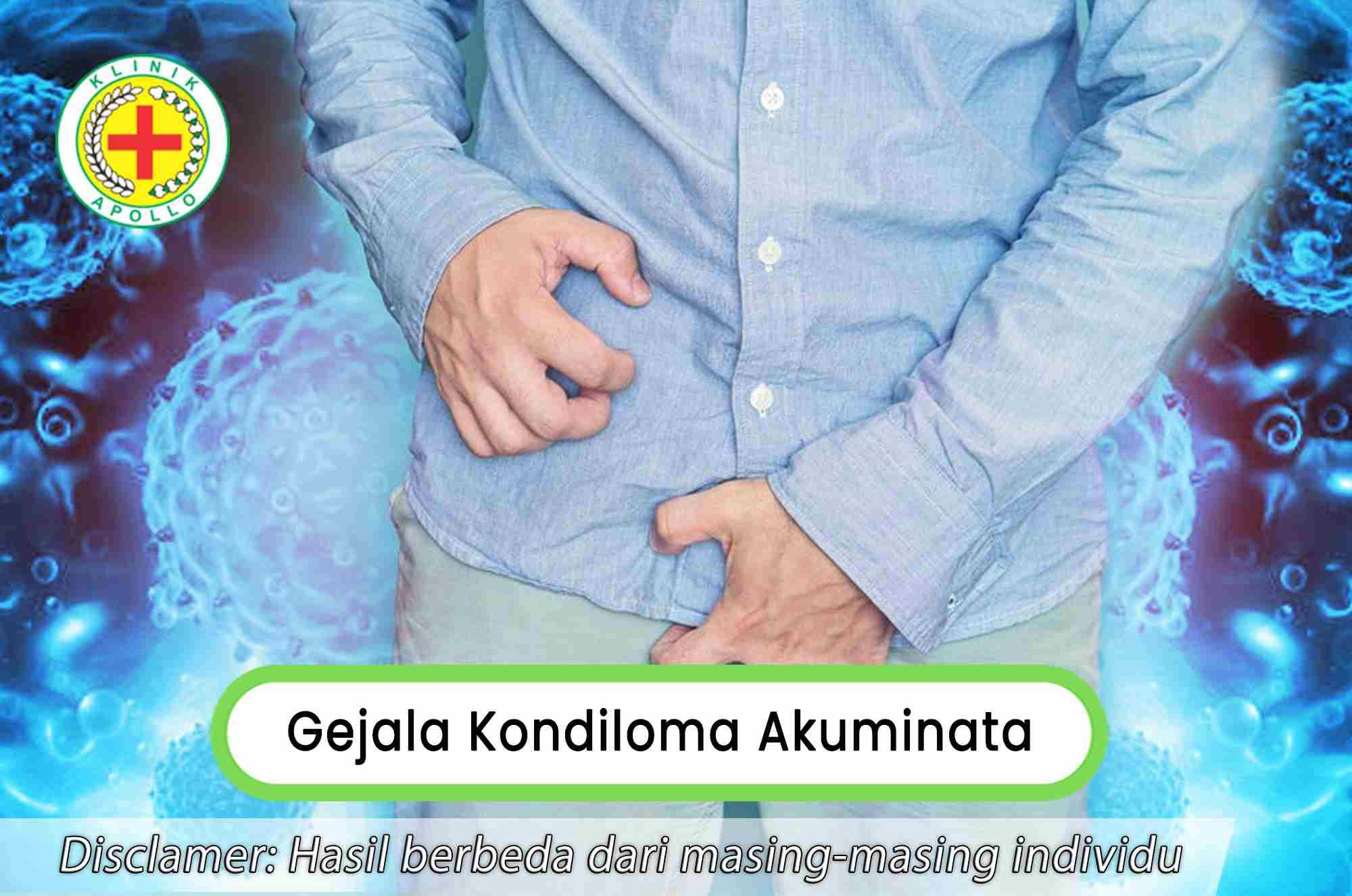 Lakukan pemeriksaan medis dan ketahui gejala kondiloma akuminata serta lakukan penanganan dengan segera.