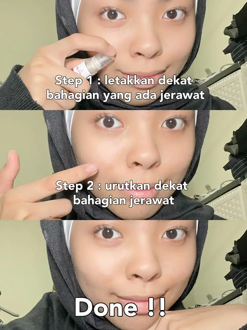 cara menghilangkan jerawat