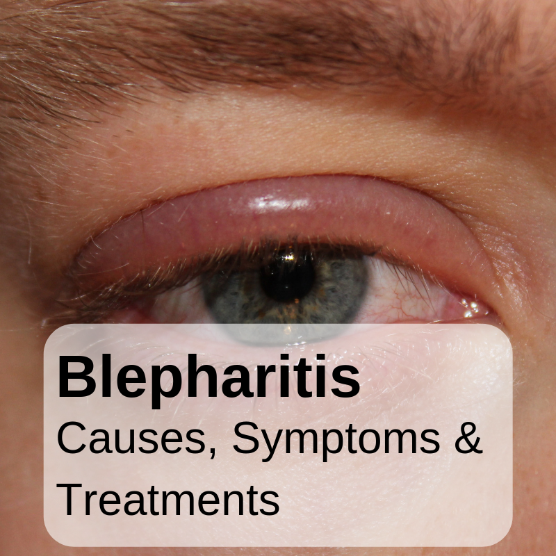 newborn blepharitis