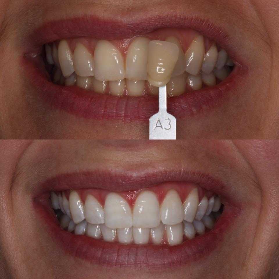 Local Dentist