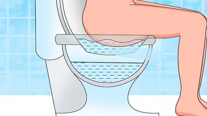 درمان درد بواسیر با حمام سیتز