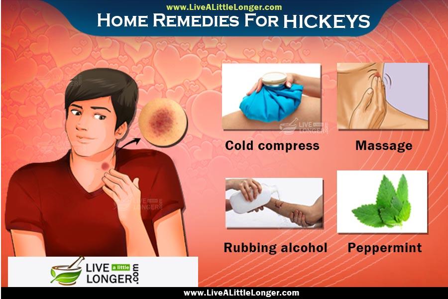 how to remove a hickeys fast