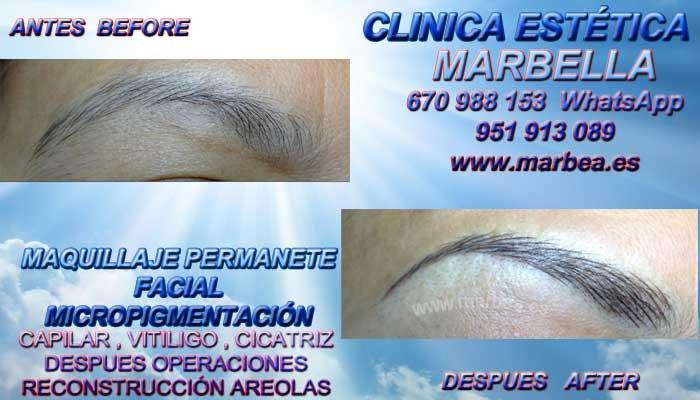 micropigmentación en Marbella en la clínica estetica entrega micropigmentación en Marbella cejas y maquillaje permanente