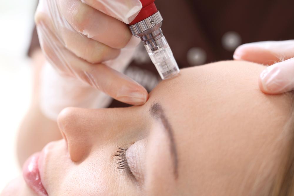 Best Mesotherapy in Singapore, Key Treatment for Radiant Skin