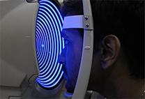 Keratoconus Keratoconus