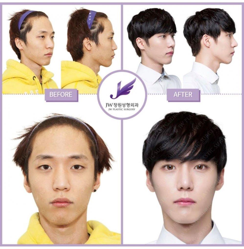 Benh vien tham my JW - Diem den uy tin cua nguoi lam dep hinh anh 8