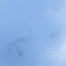 Impression of floaters, as seen against a blue sky.