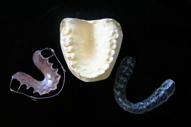 orthodontic-315784_1280_small.jpg