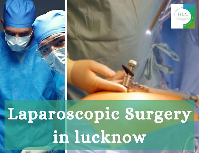Laparoscopic Surgery in lucknow