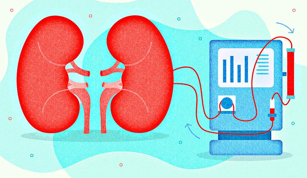 kidney-dialysis-process.jpeg