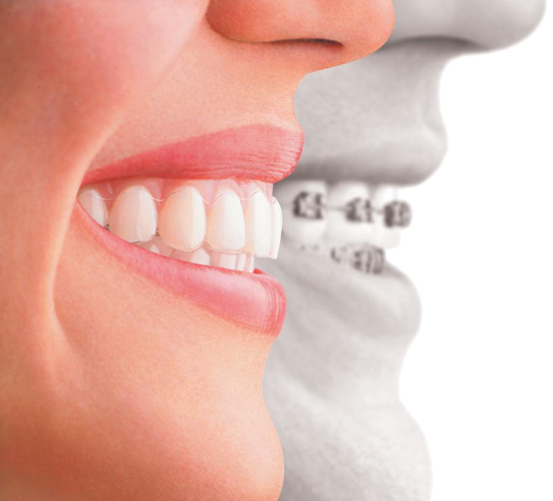 orthodontics canberra