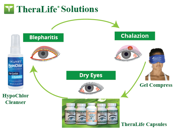 reduce ocular rosacea flare-ups
