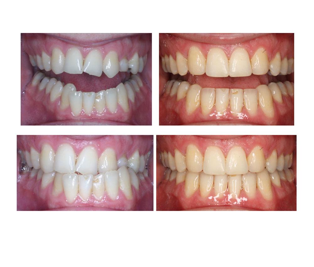 Sam Whittle Orthodontist