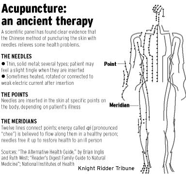 acupuncture pain control clinic
