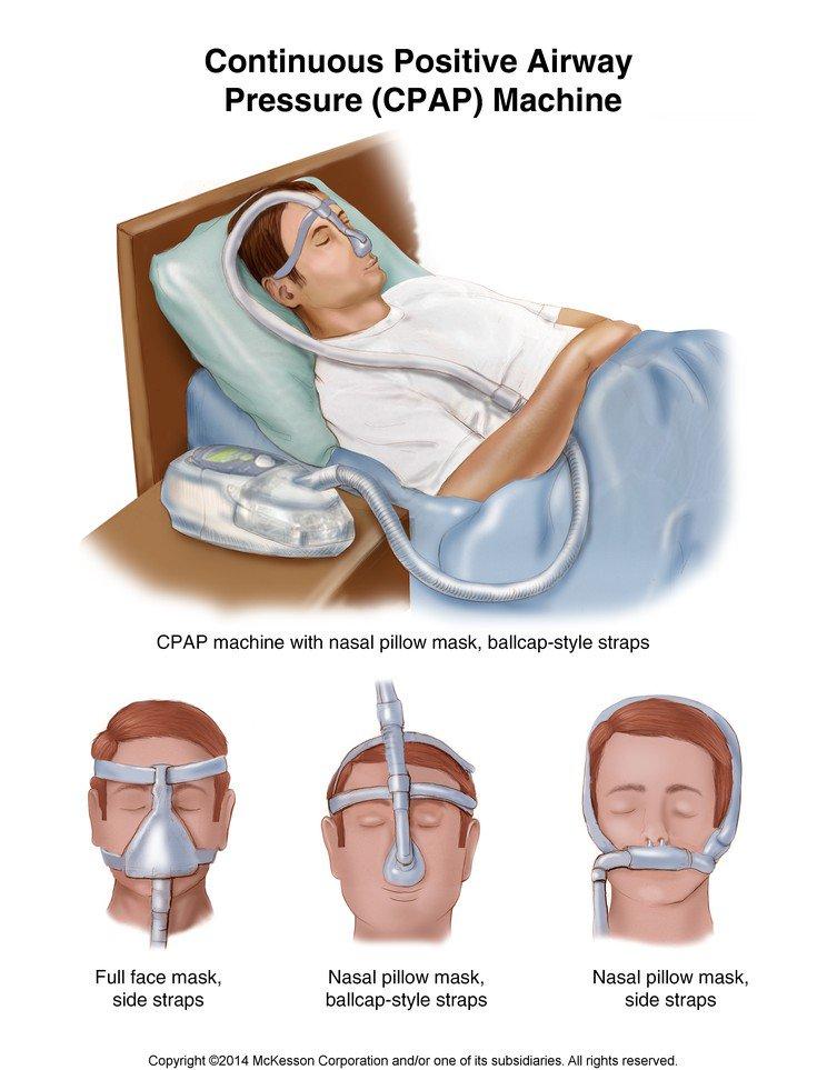 CPAP Mini Machine