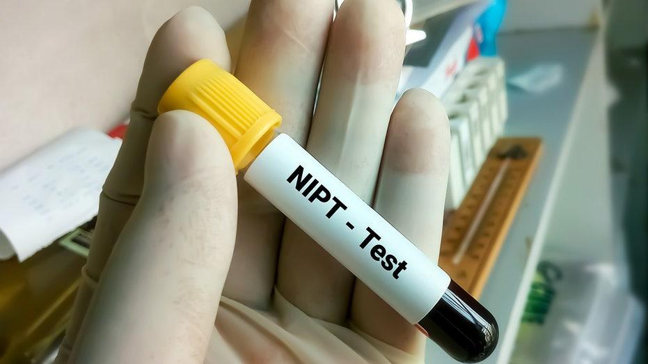 Non-Invasive Prenatal Testing (NIPT) And Why It Is Crucial, 48% OFF