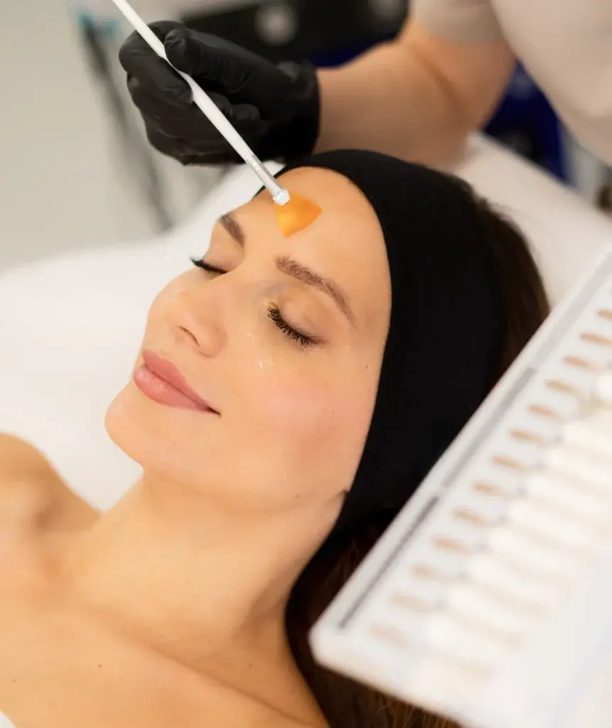 Chemical Peels in Dubai: Fine Lines, Acne Scars Treatment