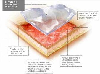 Global Anti Biofilm Wound Dressing Company market share