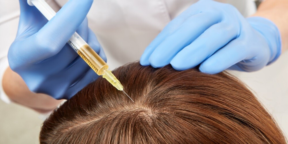 PRP hair treatment in Mumbai