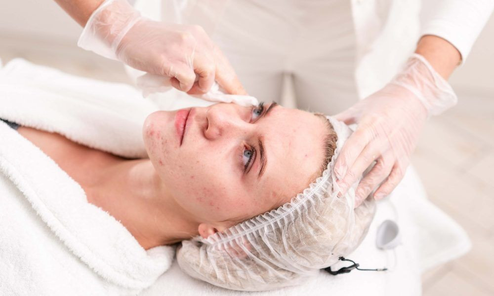 Pimple Treatment in Mumbai