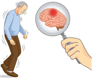 bestdoctorforparkinsons.png