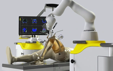 robotickneereplacementsurgeryinbangalore.png