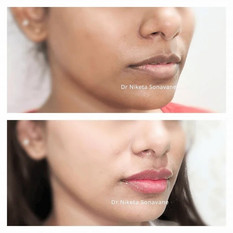 liplightningniketasonavane.jpg