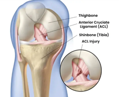 bestaclsurgeryindubai.png