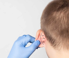 earsurgery.png