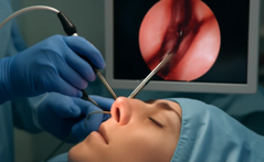 functionalendoscopicsinussurgery.png