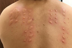 allergy1.jpg