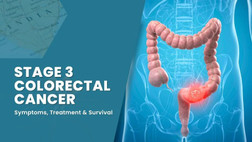stage3colorectalcancer.jpg