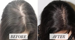 hairfalltreatmentniketa.jpg
