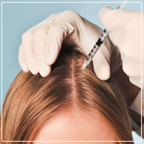 mesotherapyforhairloss.jpg