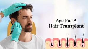 bestageforahairtransplant.png