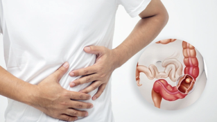 coloncancerinyoungeradults.png