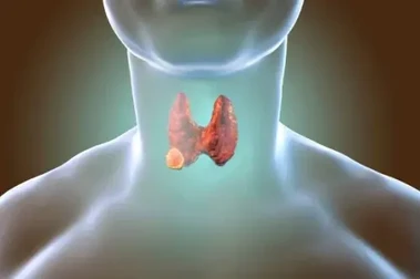 throat cancer treatment in mumbai