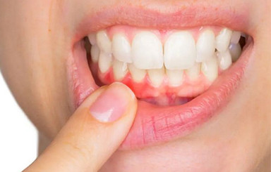teethandgum2.jpg