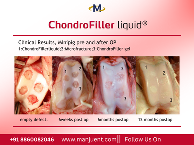 chondrofiller.png