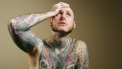 Laser Tattoo removal in Mumbai