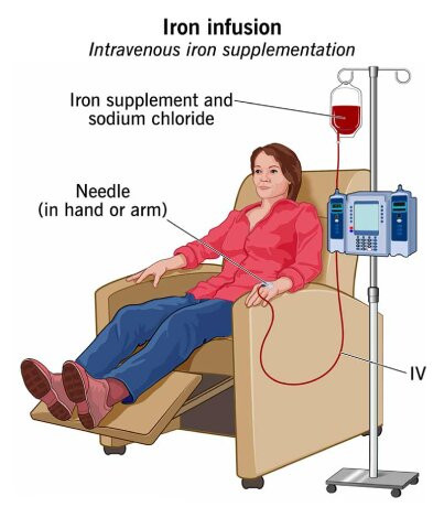 IV Infusion Therapy in Mumbai