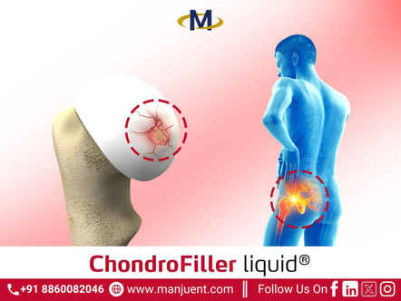 chondrofiller8.jpg