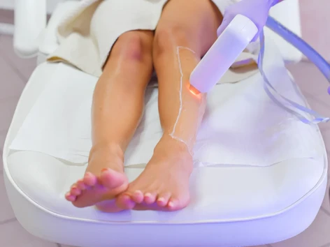 Laser hair removal cost in mumbai