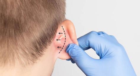 Best Ear Reconstruction Surgeon in Mumbai