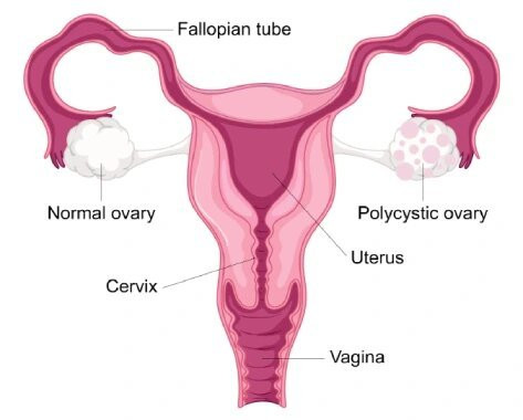 Menopause Treatment in Mumbai Menopause Treatment in Mumbai