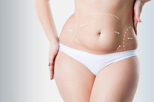 Tummy Tuck Surgery in Mumbai